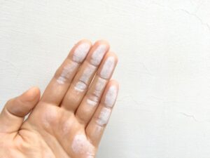 指先に付く外壁のチョーキング現象