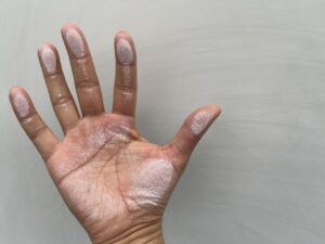 外壁のチョーキングが付いた手